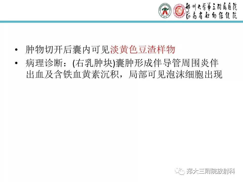 【PPT】乳腺囊肿的X线表现 【PPT】乳腺囊肿的X线表现