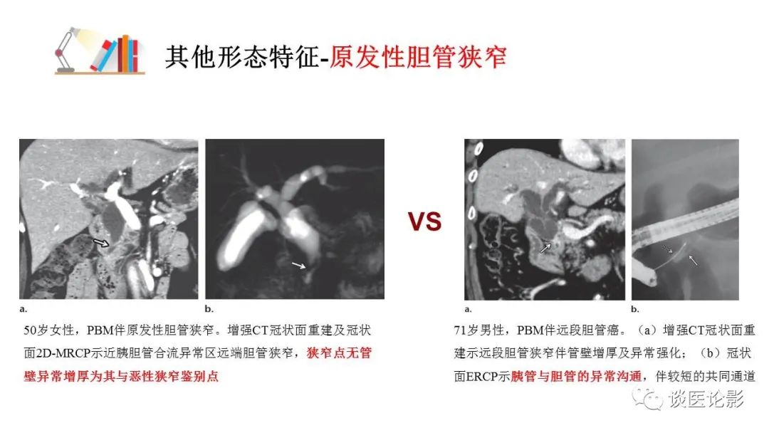 【PPT】胰—胆管合流异常影像表现