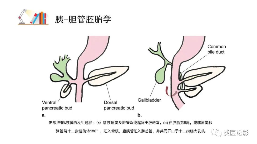 【PPT】胰—胆管合流异常影像表现