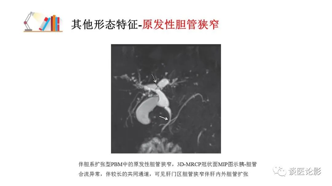 【PPT】胰—胆管合流异常影像表现