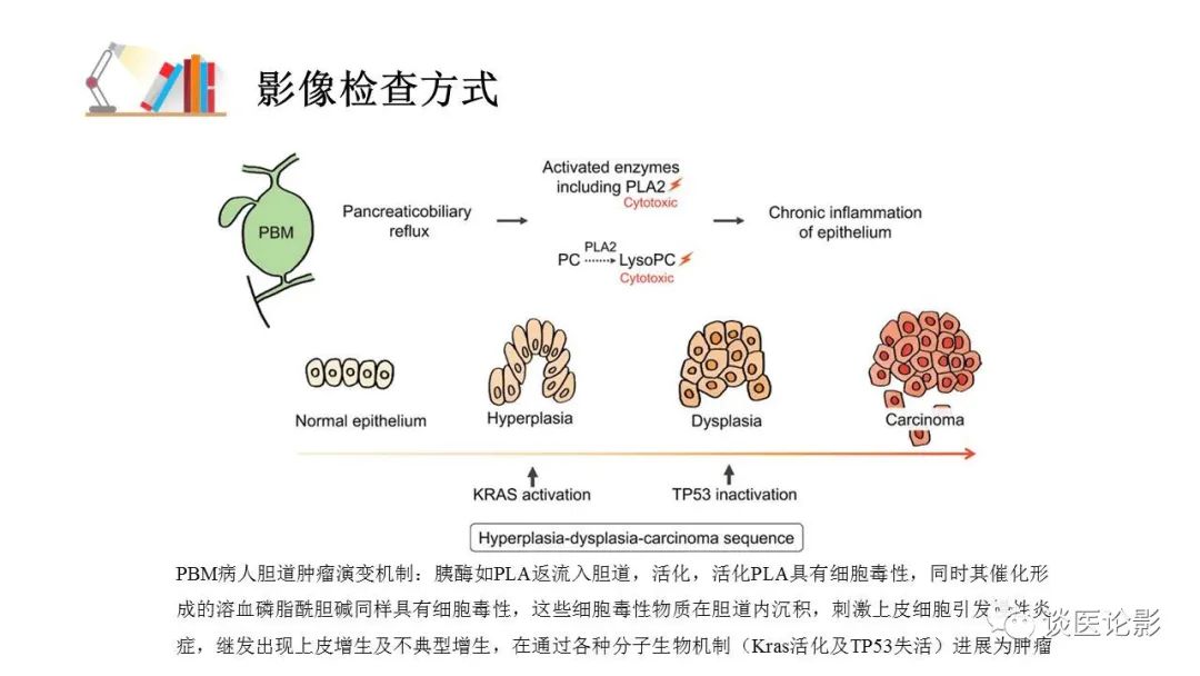 【PPT】胰—胆管合流异常影像表现