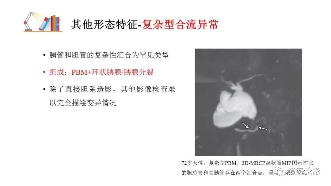 【PPT】胰—胆管合流异常影像表现