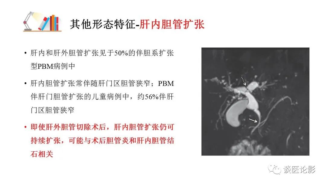 【PPT】胰—胆管合流异常影像表现