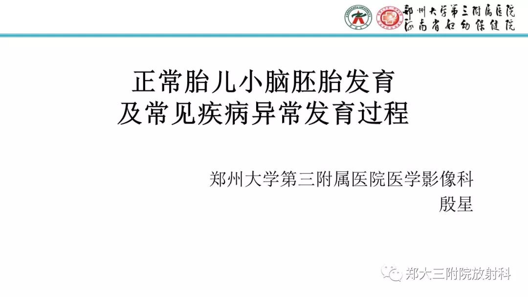 【PPT】胎儿小脑发育及常见疾病的MRI评估