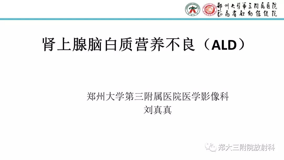 【PPT】肾上腺脑白质营养不良的影像诊断