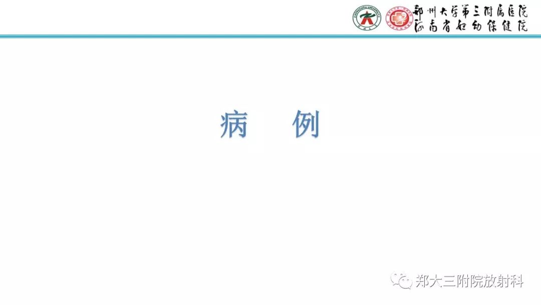 【PPT】肾上腺脑白质营养不良的影像诊断 【PPT】肾上腺脑白质营养不良的影像诊断