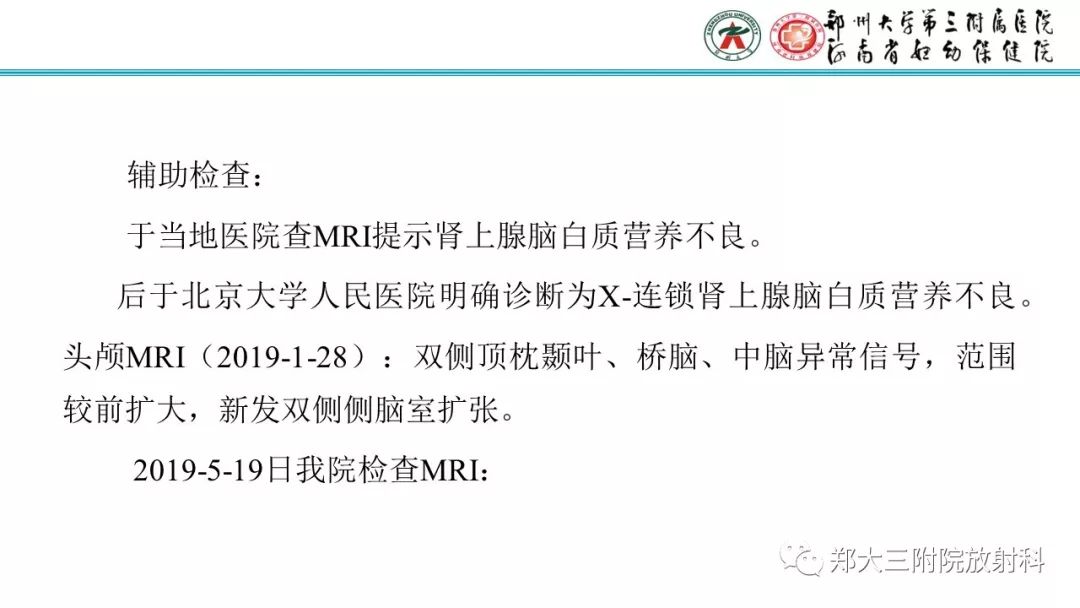 【PPT】肾上腺脑白质营养不良的影像诊断 【PPT】肾上腺脑白质营养不良的影像诊断