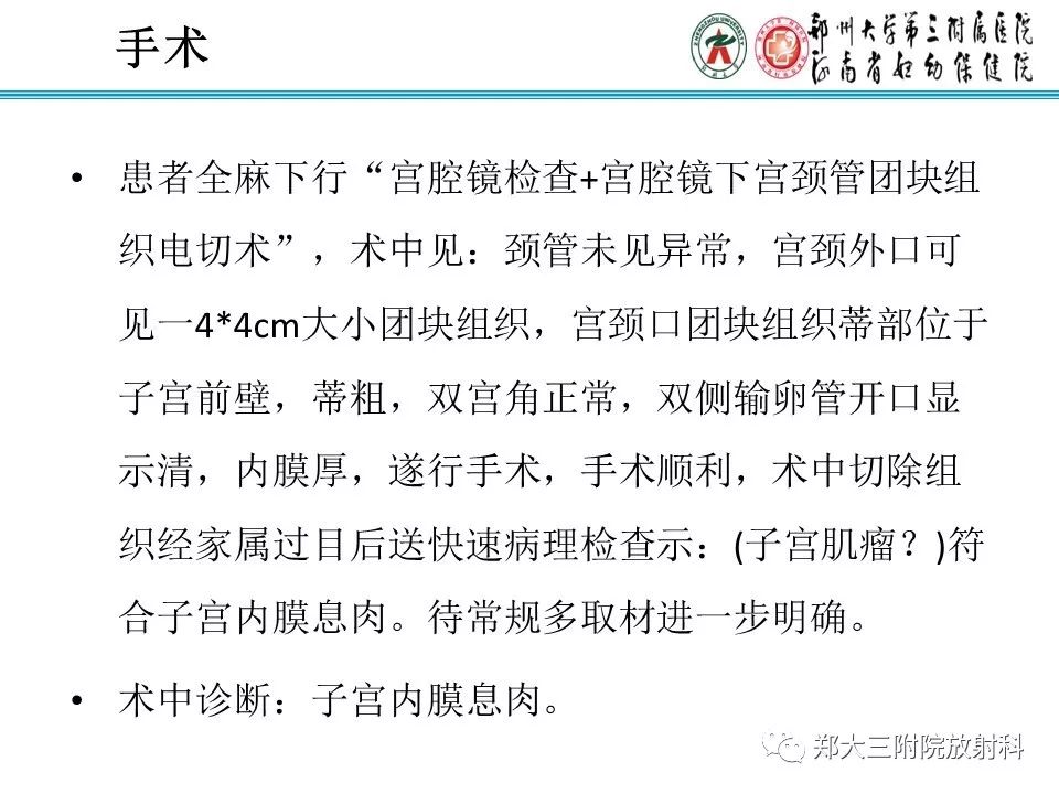 【病例】子宫腺肌瘤性息肉1例MR影像 【病例】子宫腺肌瘤性息肉1例MR影像