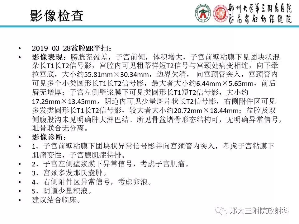 【病例】子宫腺肌瘤性息肉1例MR影像 【病例】子宫腺肌瘤性息肉1例MR影像