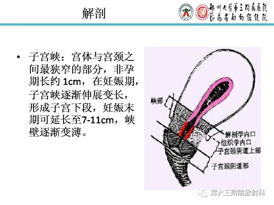 【PPT】育龄期女性正常子宫的MRI表现