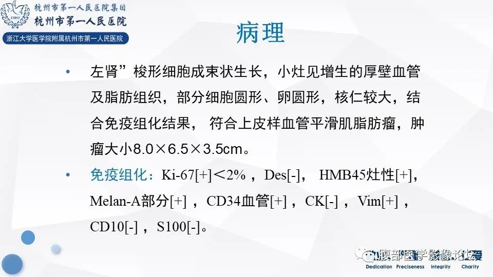 【病例】肾脏上皮样血管平滑肌脂肪瘤1例CT及MR影像