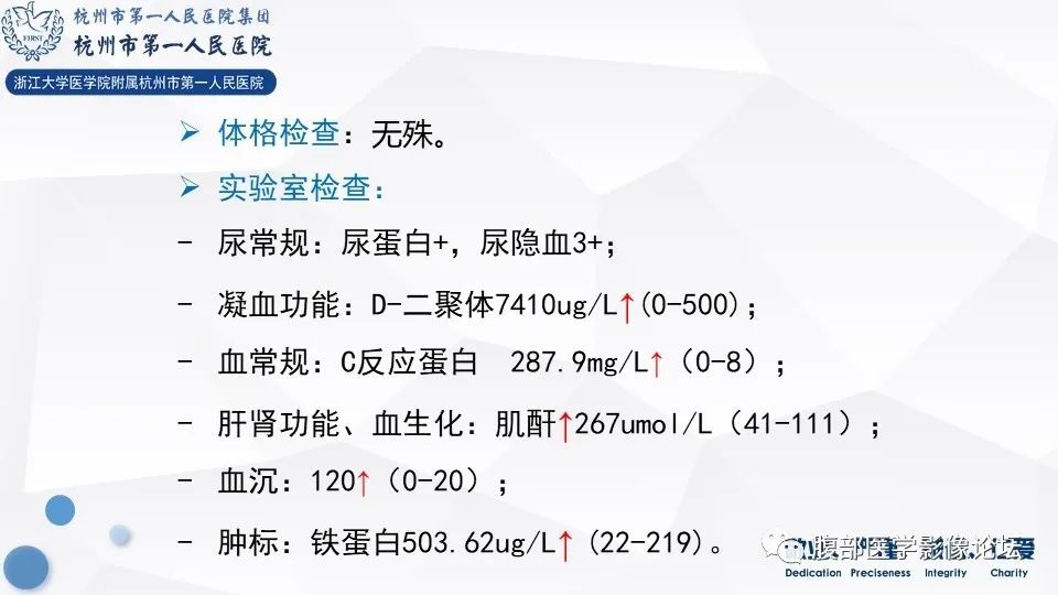 【病例】肾脏上皮样血管平滑肌脂肪瘤1例CT及MR影像
