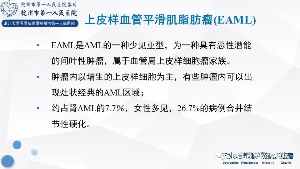 【病例】肾脏上皮样血管平滑肌脂肪瘤1例CT及MR影像