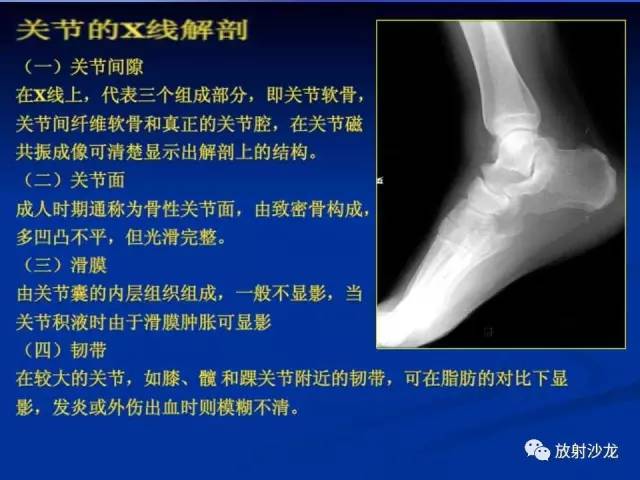 【PPT】骨、关节X线表现、正常变异