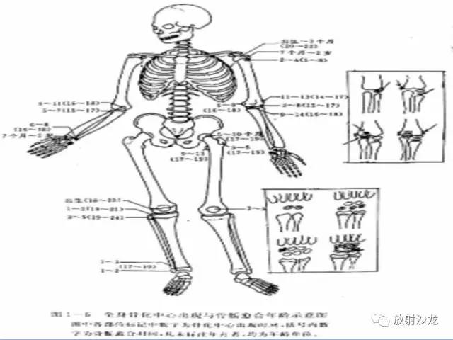 【PPT】骨、关节X线表现、正常变异