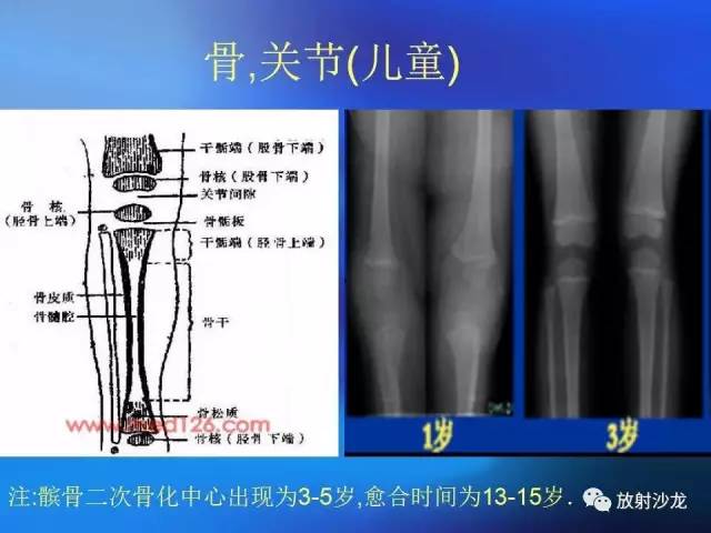 【PPT】骨、关节X线表现、正常变异
