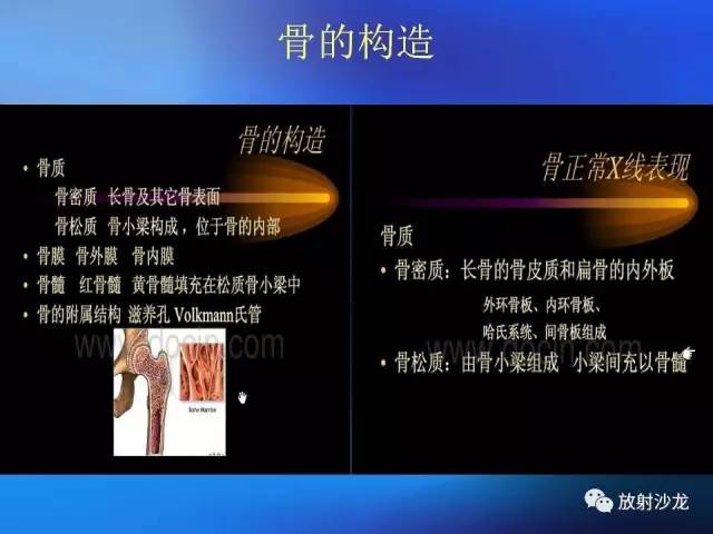 【PPT】骨、关节X线表现、正常变异