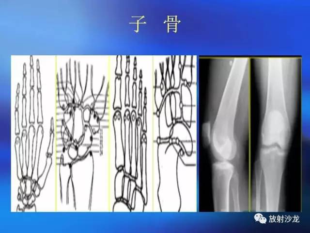 【PPT】骨、关节X线表现、正常变异
