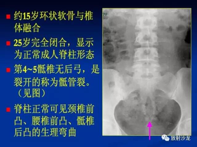 【PPT】骨、关节X线表现、正常变异