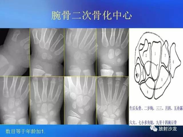 【PPT】骨、关节X线表现、正常变异