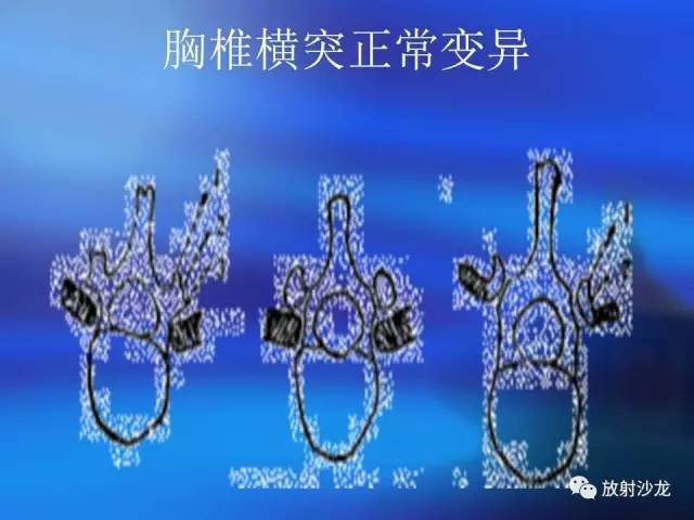 【PPT】骨、关节X线表现、正常变异