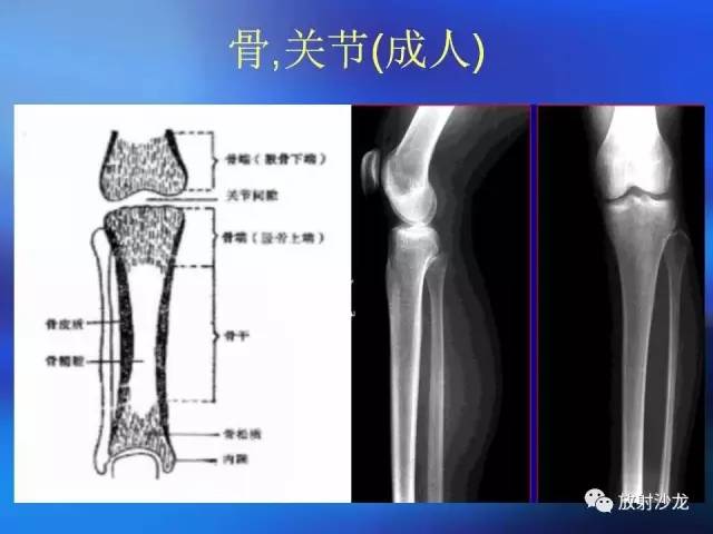 【PPT】骨、关节X线表现、正常变异