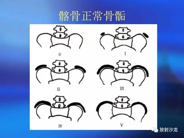 【PPT】骨、关节X线表现、正常变异