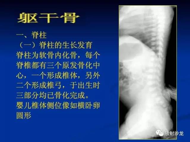 【PPT】骨、关节X线表现、正常变异