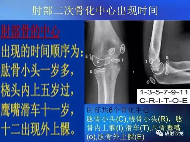 【PPT】骨、关节X线表现、正常变异