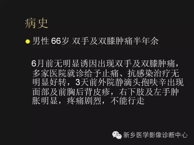 【病例】痛风1例X线影像表现