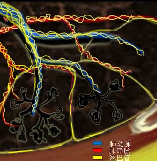 磨玻璃影？警惕9大感染性疾病