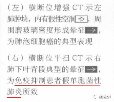 “晕征、反晕征”的鉴别诊断