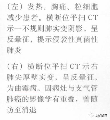 “晕征、反晕征”的鉴别诊断
