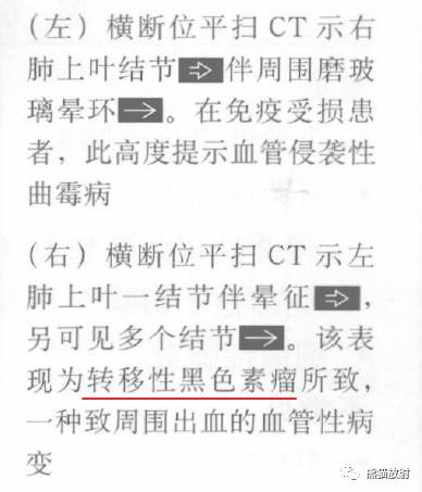 “晕征、反晕征”的鉴别诊断