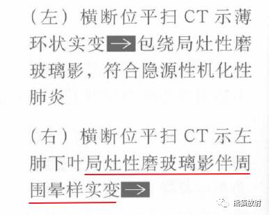 “晕征、反晕征”的鉴别诊断