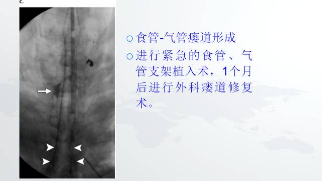 【PPT】穿透性经纵隔损伤的影像学评估 【PPT】穿透性经纵隔损伤的影像学评估