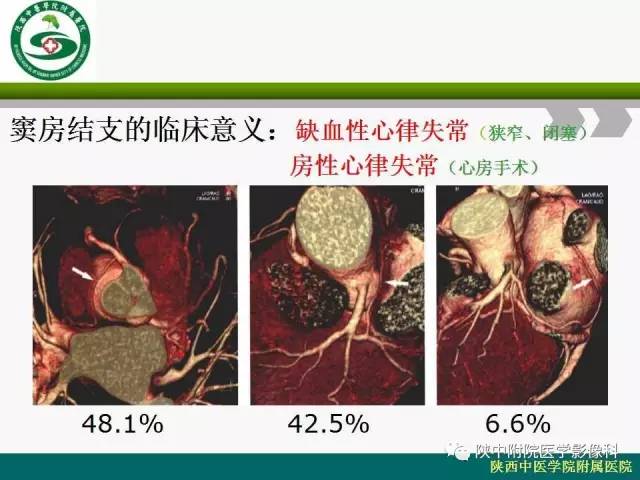 【PPT】冠状动脉、静脉正常解剖与变异