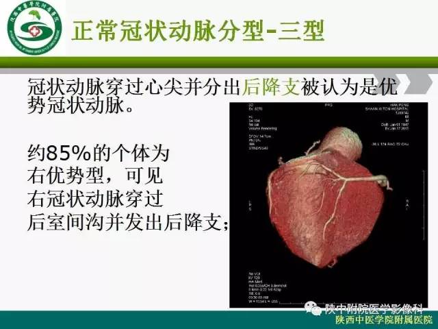 【PPT】冠状动脉、静脉正常解剖与变异