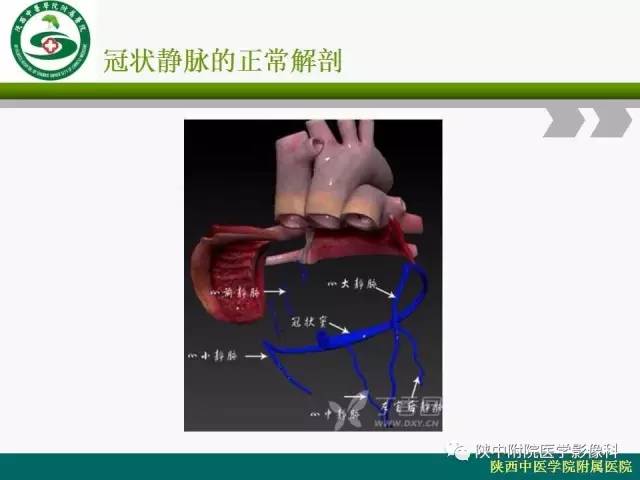 【PPT】冠状动脉、静脉正常解剖与变异