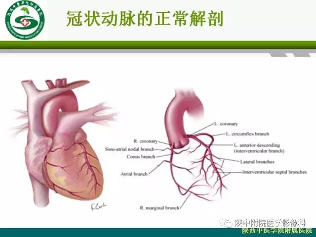 【PPT】冠状动脉、静脉正常解剖与变异