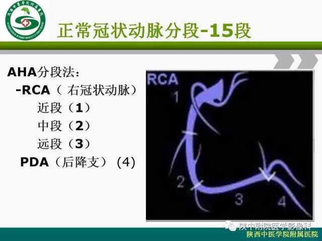 【PPT】冠状动脉、静脉正常解剖与变异