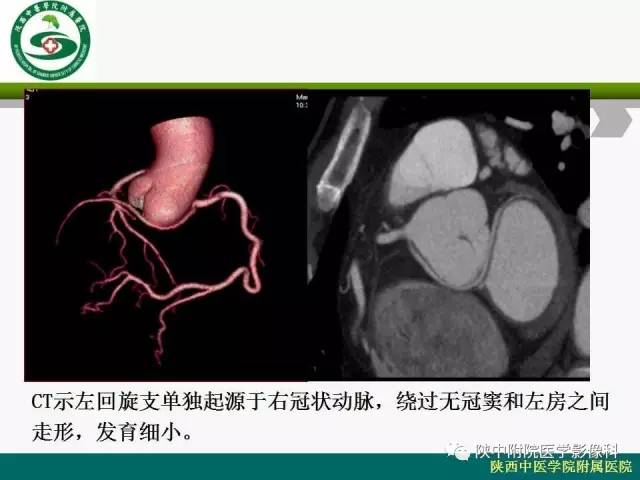 【PPT】冠状动脉、静脉正常解剖与变异
