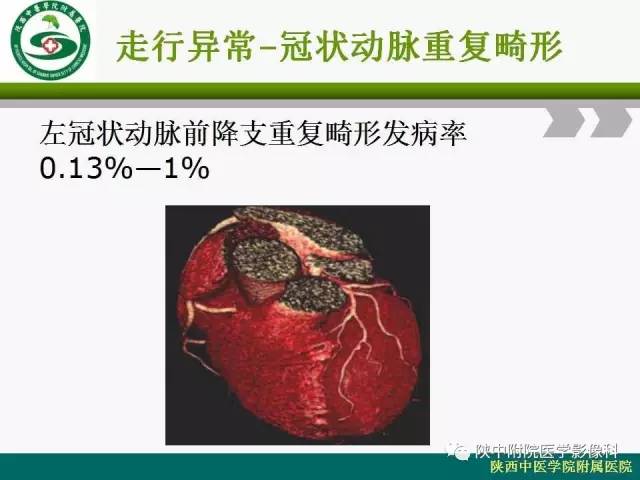 【PPT】冠状动脉、静脉正常解剖与变异