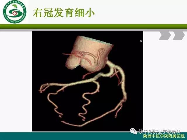 【PPT】冠状动脉、静脉正常解剖与变异