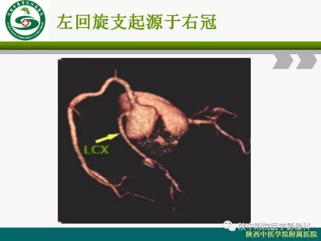 【PPT】冠状动脉、静脉正常解剖与变异