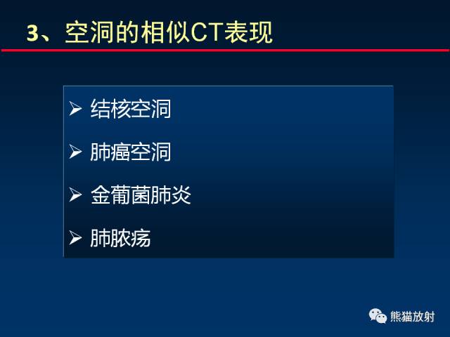 【PPT】肺曲霉菌病：放射科医生如何应对