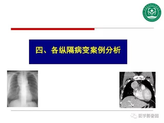 【PPT】纵隔肿瘤的影像检查规范及诊断思路