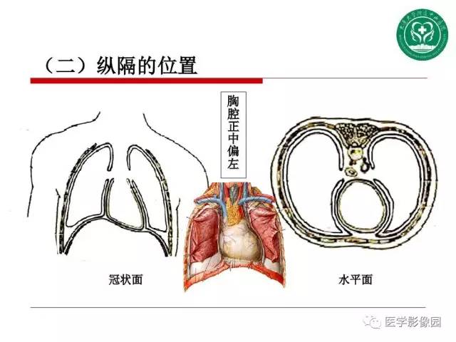【PPT】纵隔肿瘤的影像检查规范及诊断思路