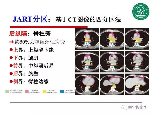 【PPT】纵隔肿瘤的影像检查规范及诊断思路