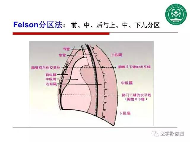 【PPT】纵隔肿瘤的影像检查规范及诊断思路